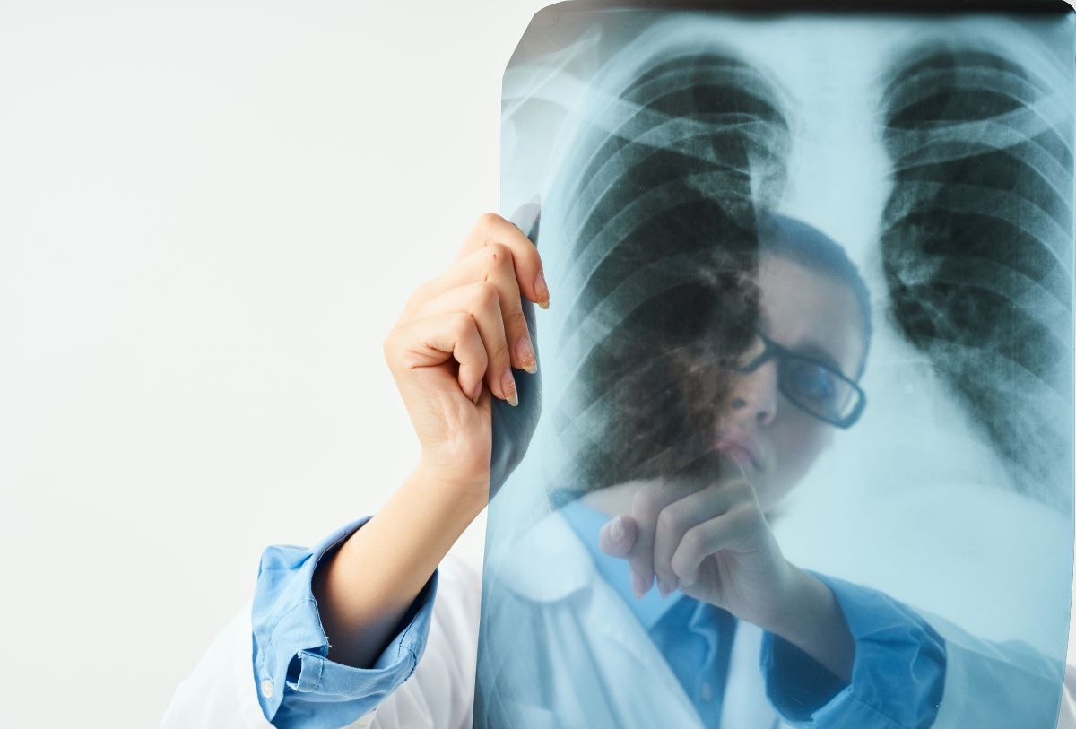 Radiografía a un pulmón humano